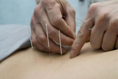 Acupuncture pour l'ostéochondrose de la région thoracique.